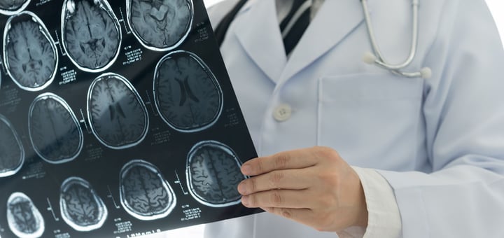 היחידה להדמייה פונקציונאלית - FMRI הדסה עין כרם