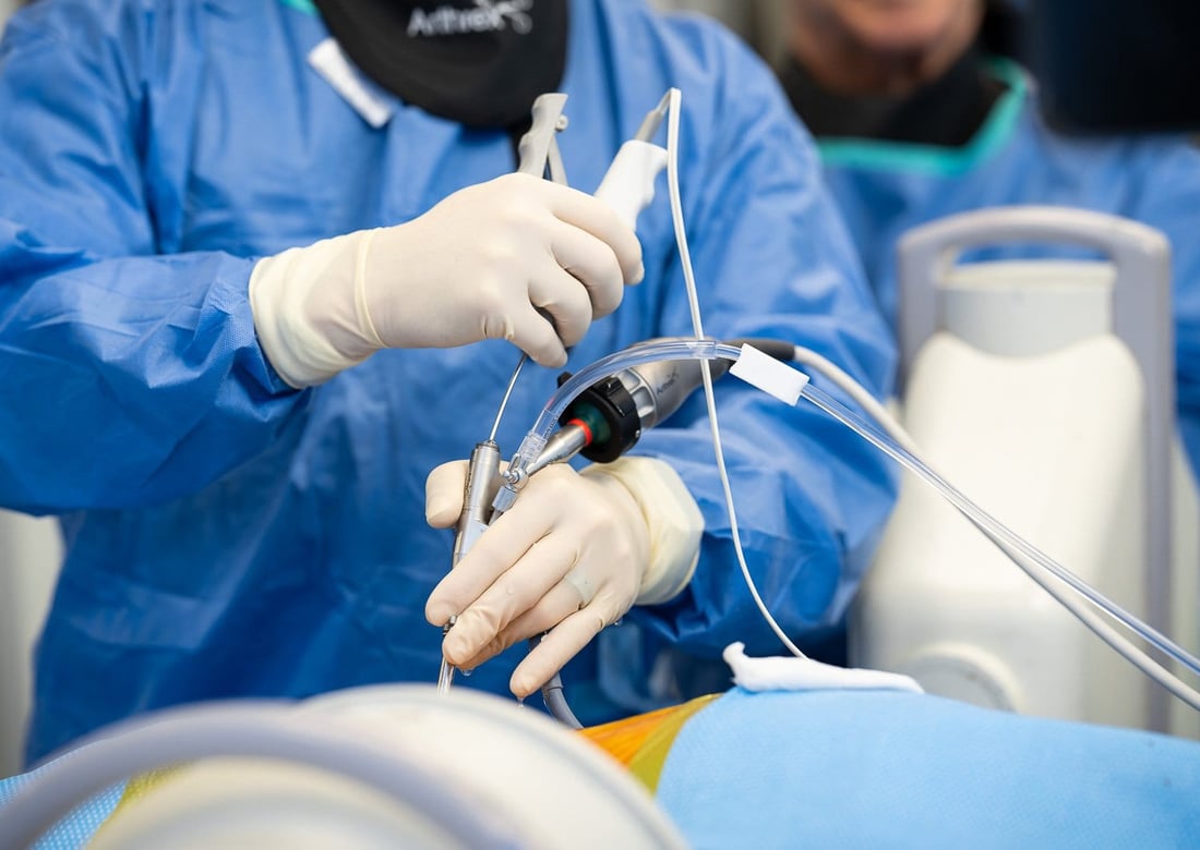 Minimally invasive endoscopic spine surgery — pencil-width access corridor