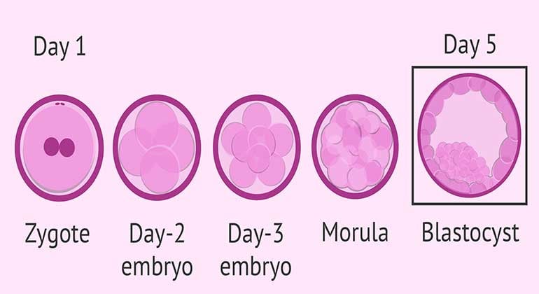Blastocyst Culture and Transfer in Udaipur