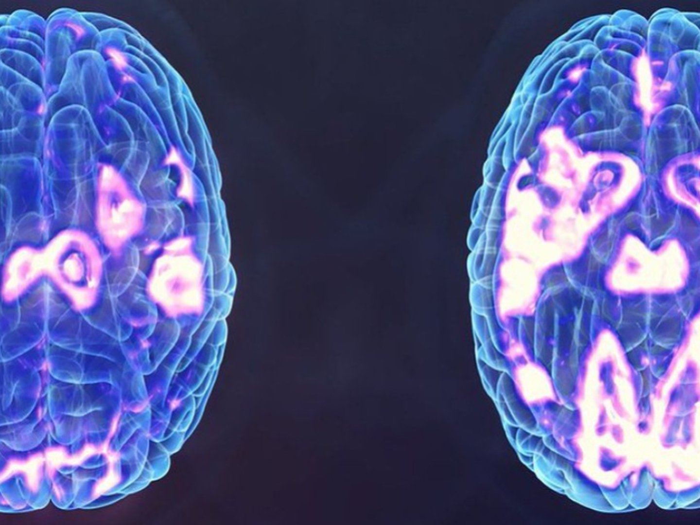 Proximity Nova gallery image