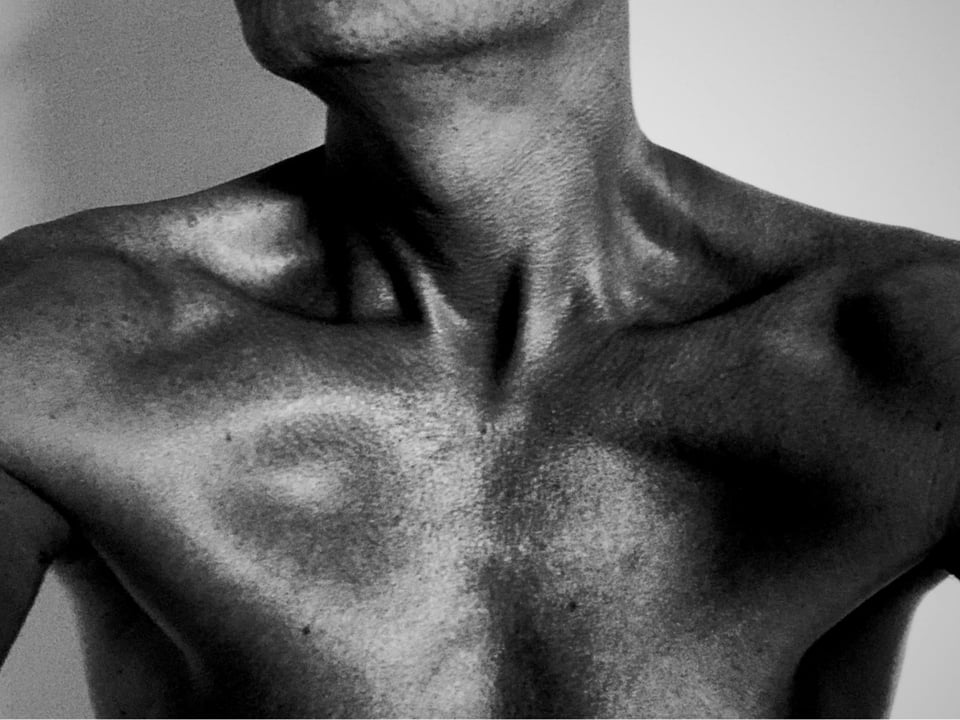 You can see we understand quite a bit about what Shoulder replacement services do