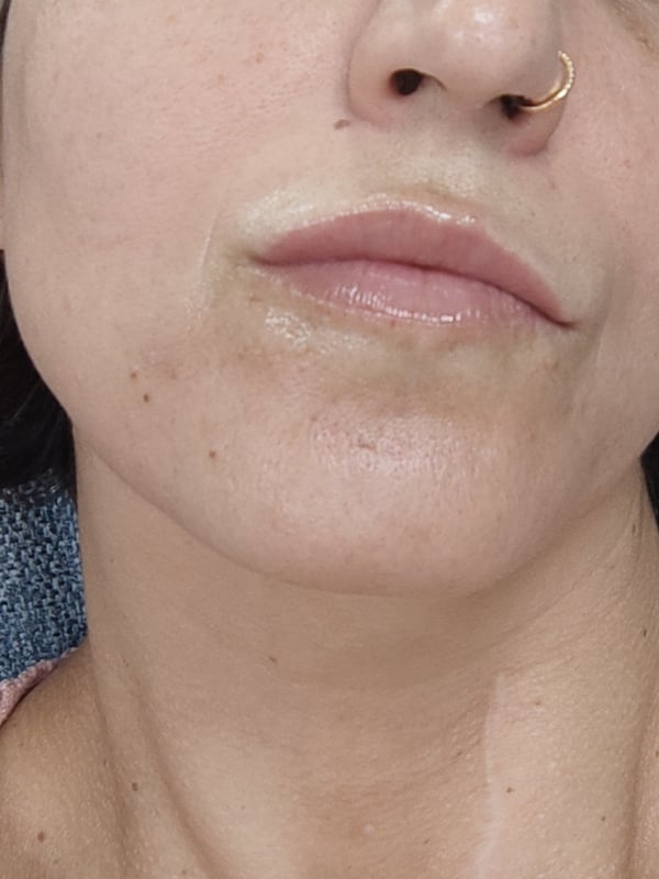 Close-up portrait of a young woman with glossy lips and a small nose ring, making a subtle pout.