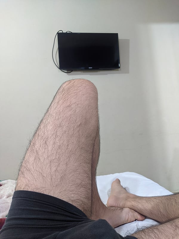 Close-up of a person's hairy legs and feet resting on a bed, with a television mounted on the wall in the background.