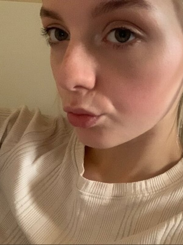 Close-up selfie of a young woman with platinum blonde hair making a playful pout, wearing a light-colored top.