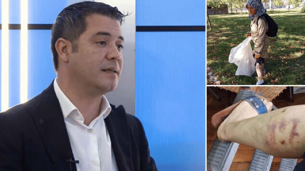 İBB'deki köpek ısırma olayıyla ilgili soruşturma başlatıldı