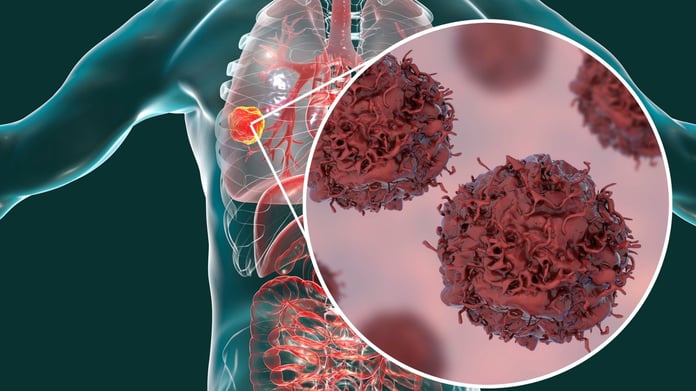 Kansersiz yaşamın sırrı yüzyıl önce keşfedilmiş! Her gün çiğ çiğ tüketilmesi gereken besinler