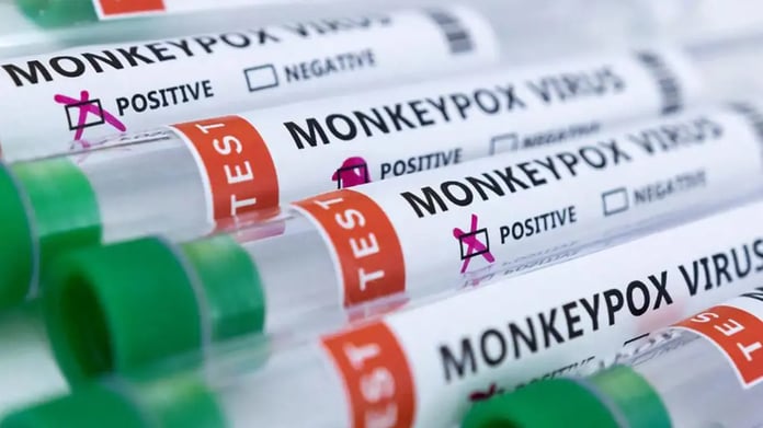 Kaşınıyorsanız DİKKAT! Maymun Çiçeği Türkiye’de var mı? Maymun çiçeği iz bırakır mı, kaşınır mı? Maymun Çiçeği virüsü öldürür mü?