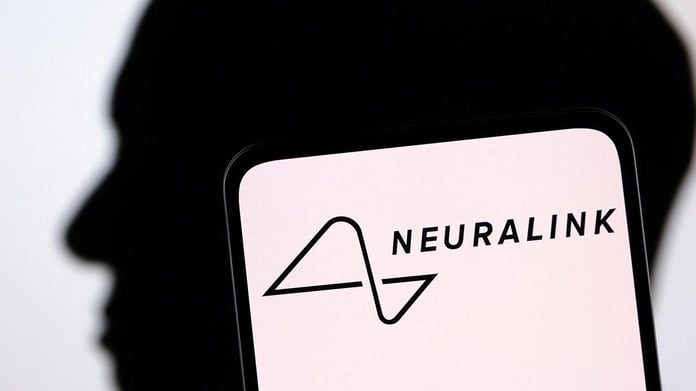 Neuralink, beyin implantı için insan denemesine başlıyor!