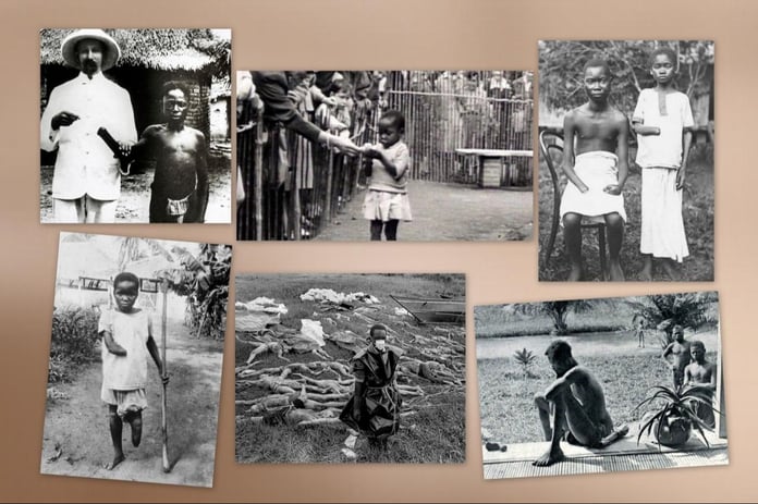 Belçika’nın Kara Tarihi: Kral II. Leopold’un Kongo Katliamı