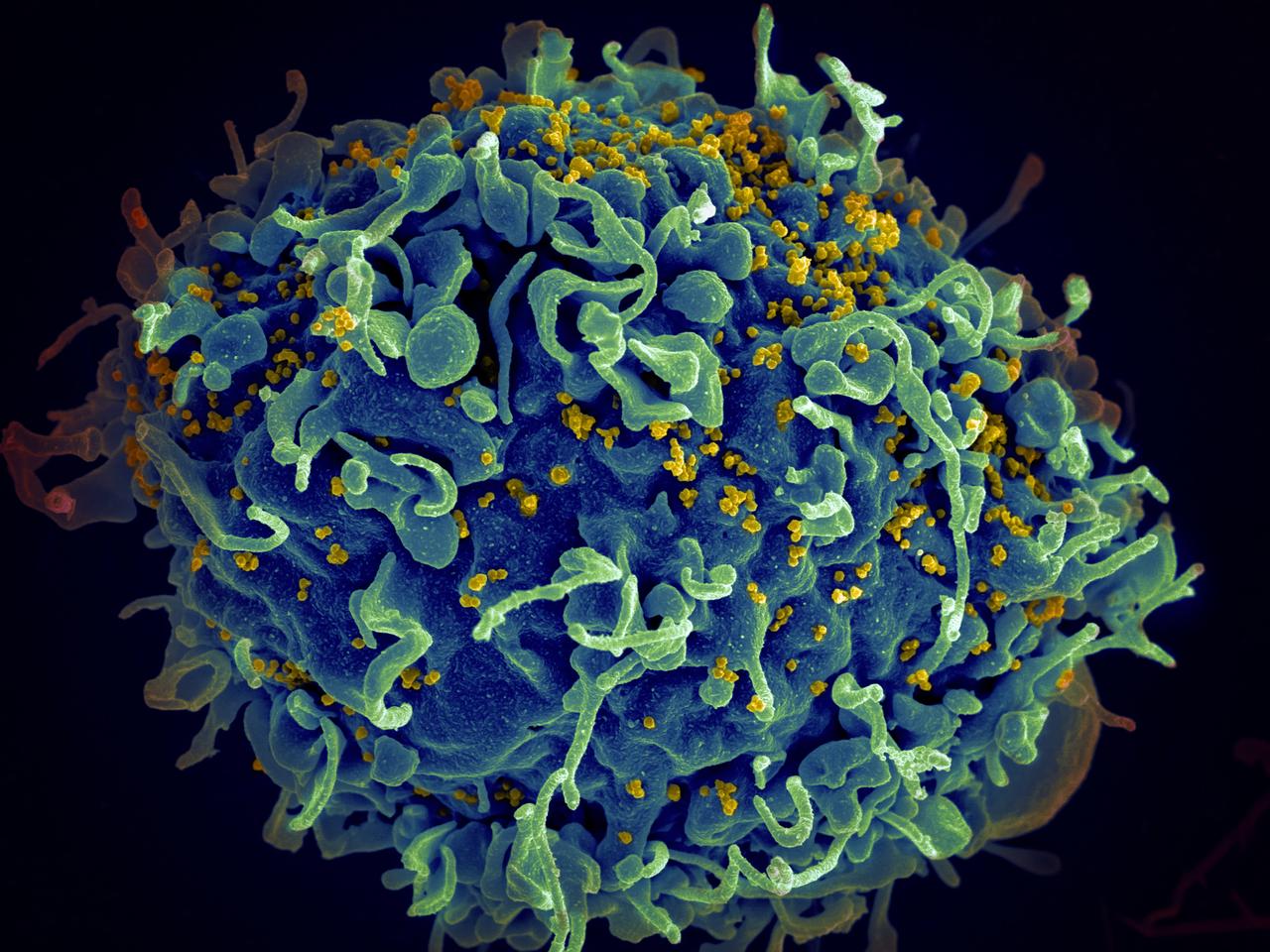 Türkiye’de HIV görülme yaşı 15’e kadar indi