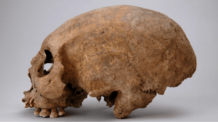 Viking kadınlarında keşfedilen 3 garip kafatası modifikasyonu