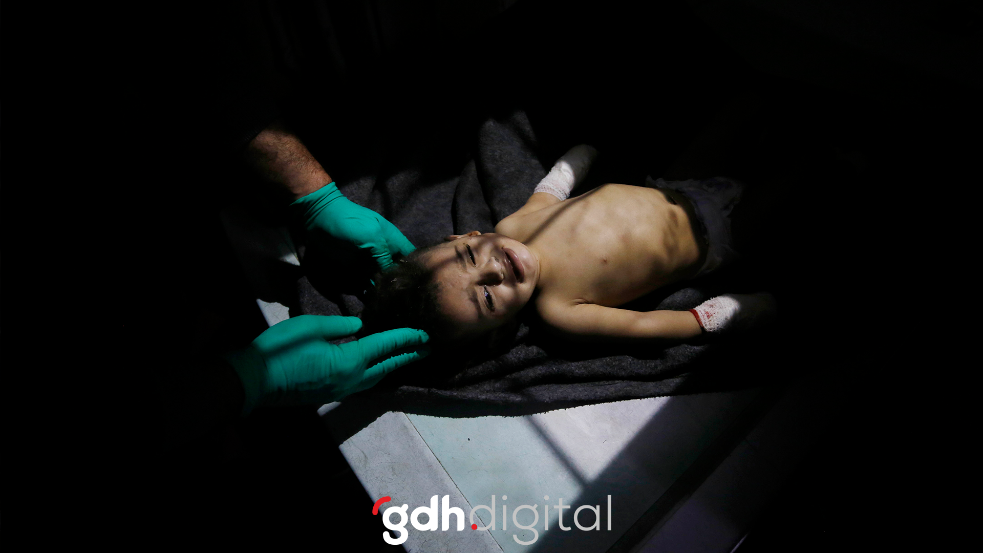 İsrail'in saldırılarında yaralanan Filistinli bebek, henüz birkaç aylıkken kimsesiz kaldı.