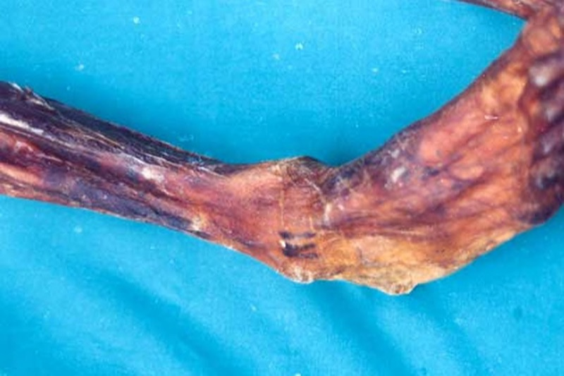 Ötzi’nin vücudunda, arkeologların ayrıca ağrı tedavisi veya ritüel için kullanımla ilgili olabileceğini teorileştirdiği bir dizi çizgi benzeri dövme var.
