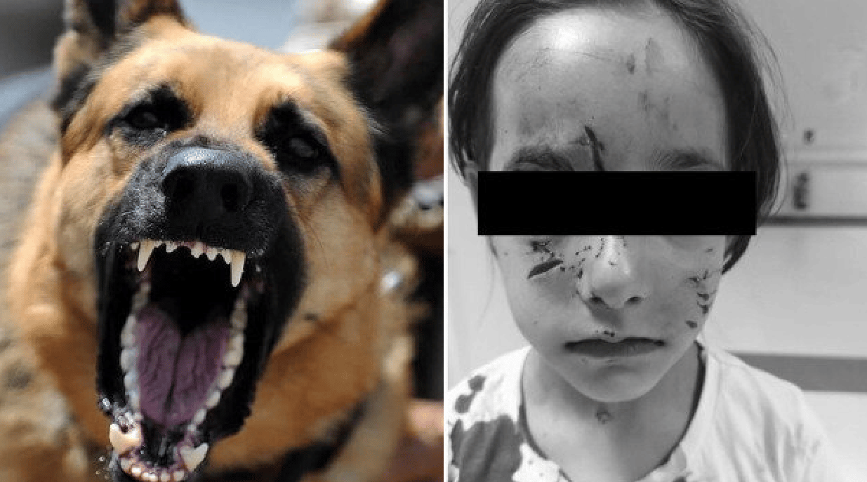 İstanbul'da başıboş köpek, 6 yaşındaki kızı yaraladı