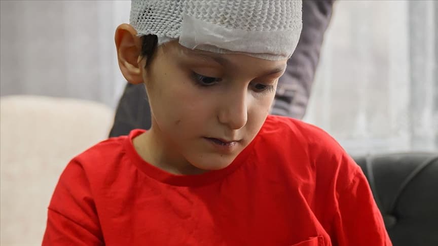 Minik Tunahan'a Köpek Saldırısı Sonrası Deri Nakli