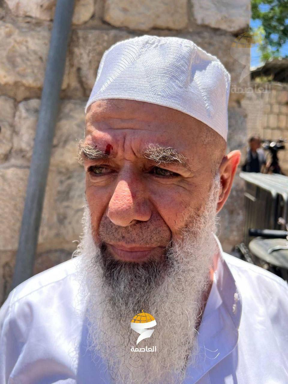 İsrail, Ebu Bekir Eş- Şeymi'ye Aslanlı Kapı'da saldırdı