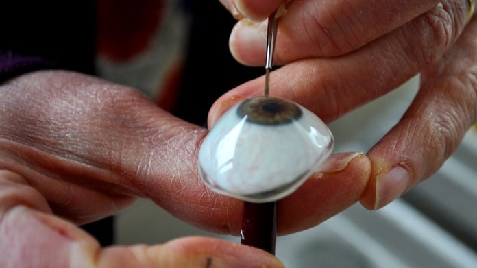 3D baskıyla üretilen protez göz