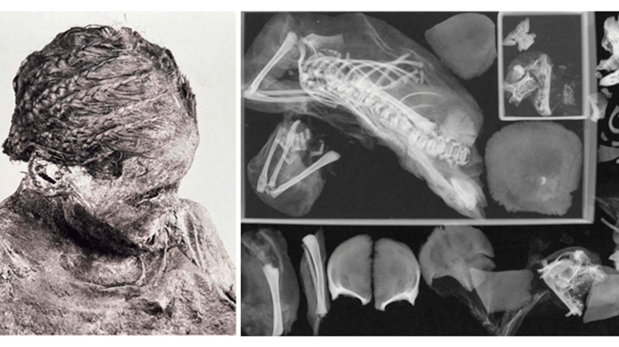 İkizlere hamile olduğu keşfedilen genç mumya ortaya çıkarıldı