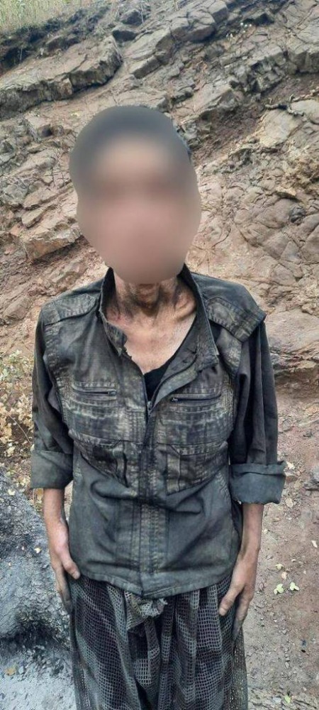 Teslim olan PKK'lı teröristlerin açlıktan bağırsaklarının delindiği ortaya çıktı