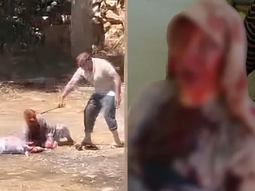  85 yaşındaki annesini sopayla dövdü 