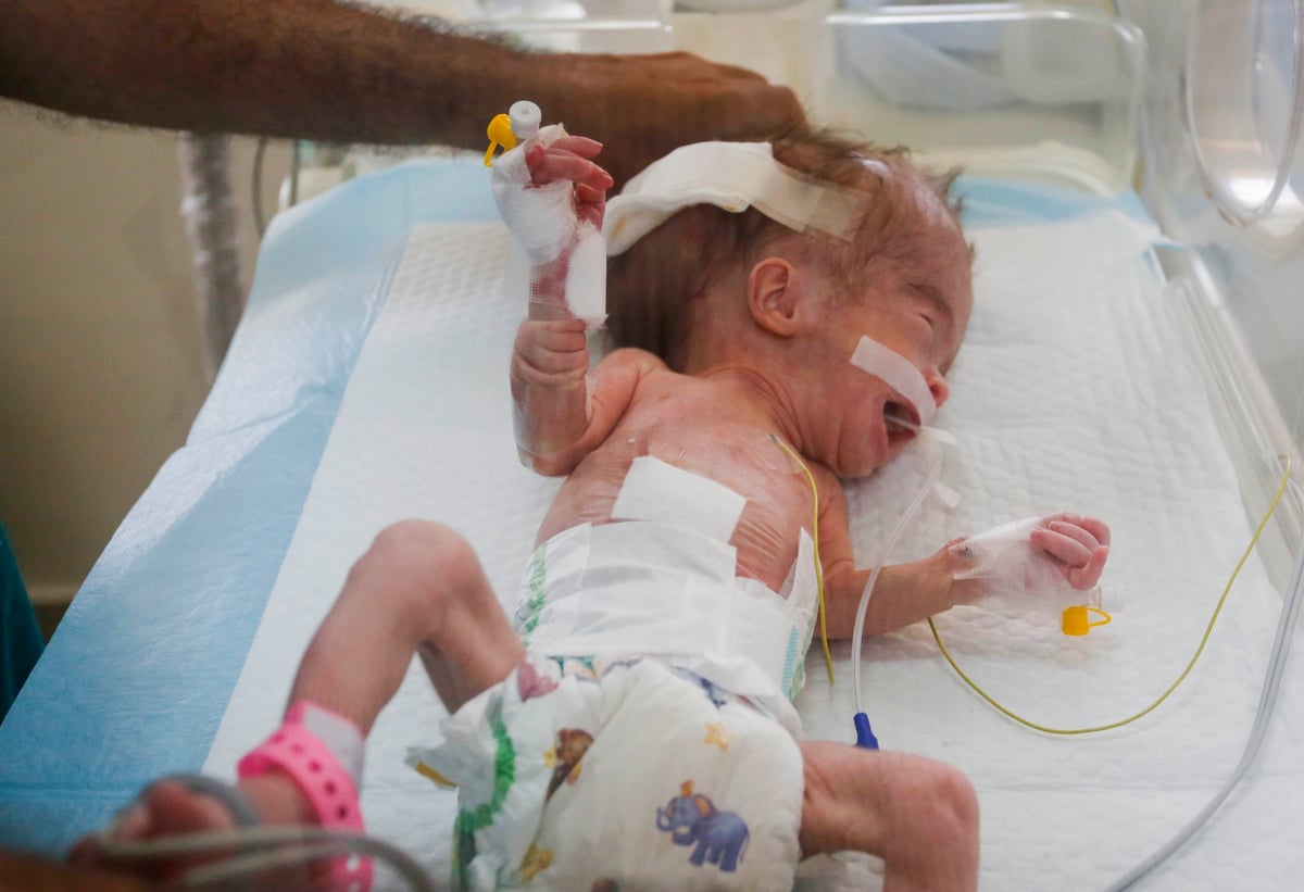 Gazze'de yeni doğan bebekler yetersiz beslenme nedeniyle ölüm tehlikesiyle karşı karşıya. (AA)