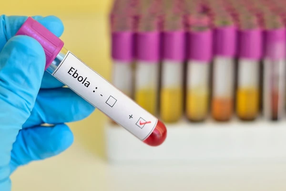 DSÖ'de acil durum: İşte Ebola salgınının belirtileri!