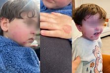 Sabah sağlıklı bıraktı, akşam morluklar içinde aldı! Gemlik’te kreş soruşturması