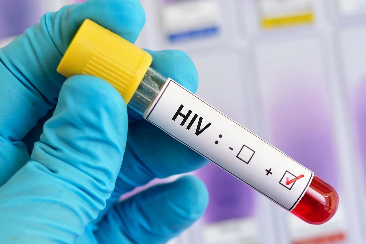 Fiji'de HIV alarmı!