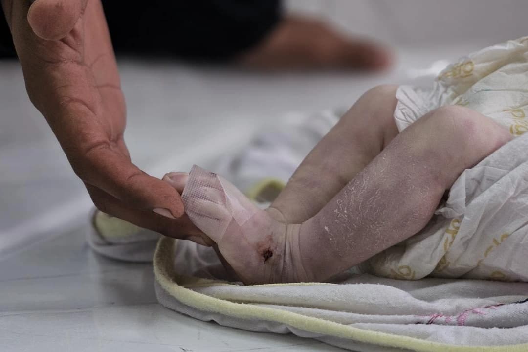 Yalova'da hamile kadına vahşet