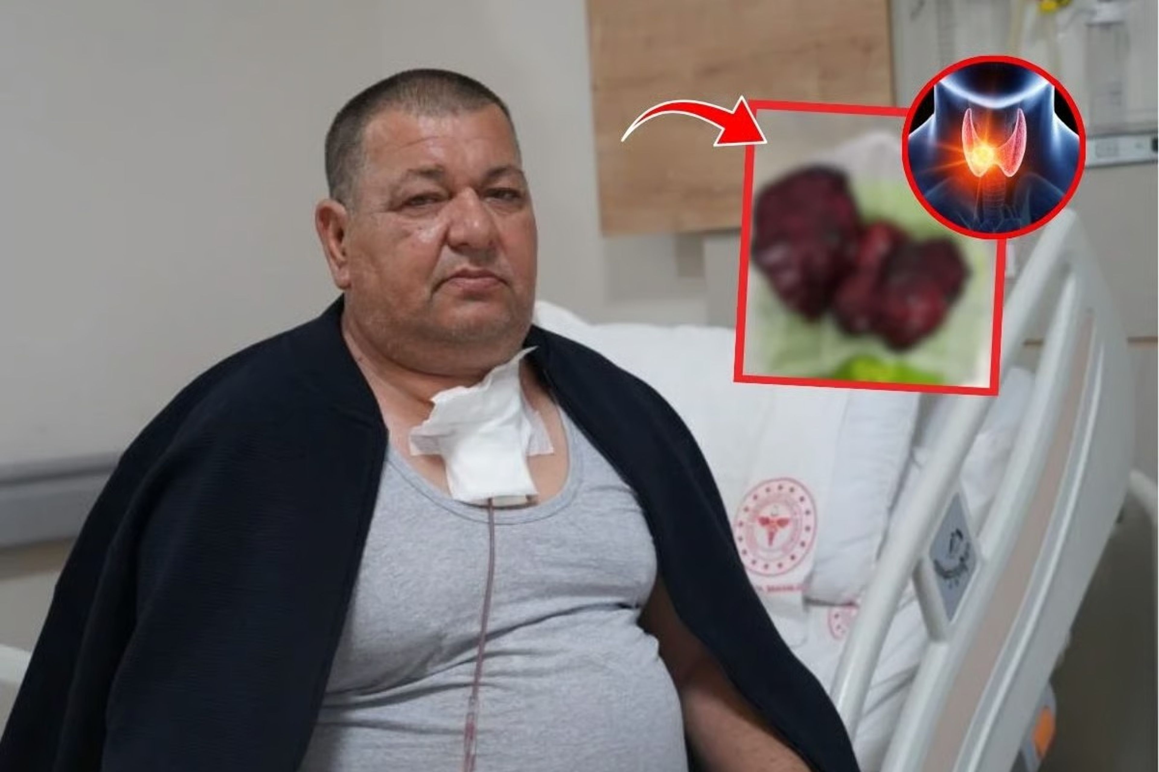 Boynundaki kitle göğüs boşluğuna kadar ilerledi: 2,5 saatlik ameliyatla nefes aldı