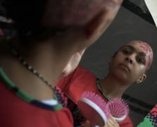 İsrail saldırılarında saçlarını kaybeden Gazzeli çocuk yardım istiyor