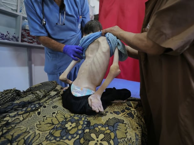 Gazze'de açlıktan ölenlerin sayısı 239'a yükseldi