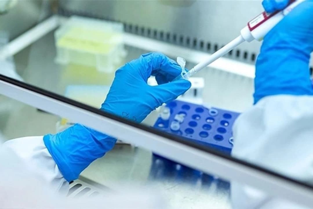 Rusya'dan kritik veba açıklaması: Vaka tespit edilmedi
