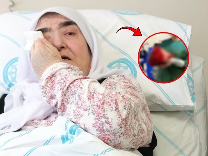 Göğüs ağrısıyla gitti, içinden çıkan görenleri dehşete düşürdü: Tam 7 kilo 750 gramlık dev tümör!