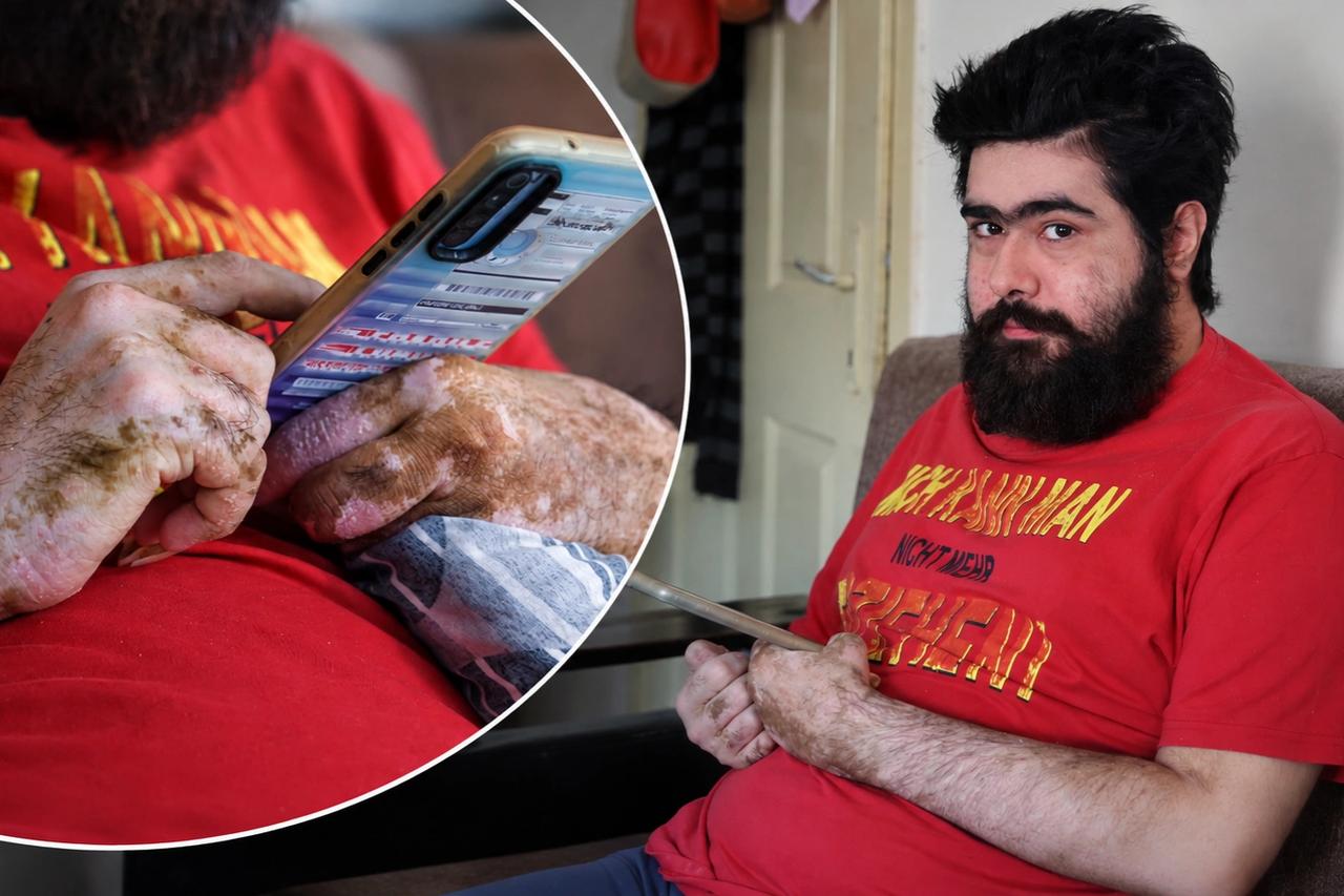 6 Şubat depremlerinin ardından gündeme gelmişti! Barış Özbay tedavisini bıraktı: “İstesem düzelirim ama istemiyorum”