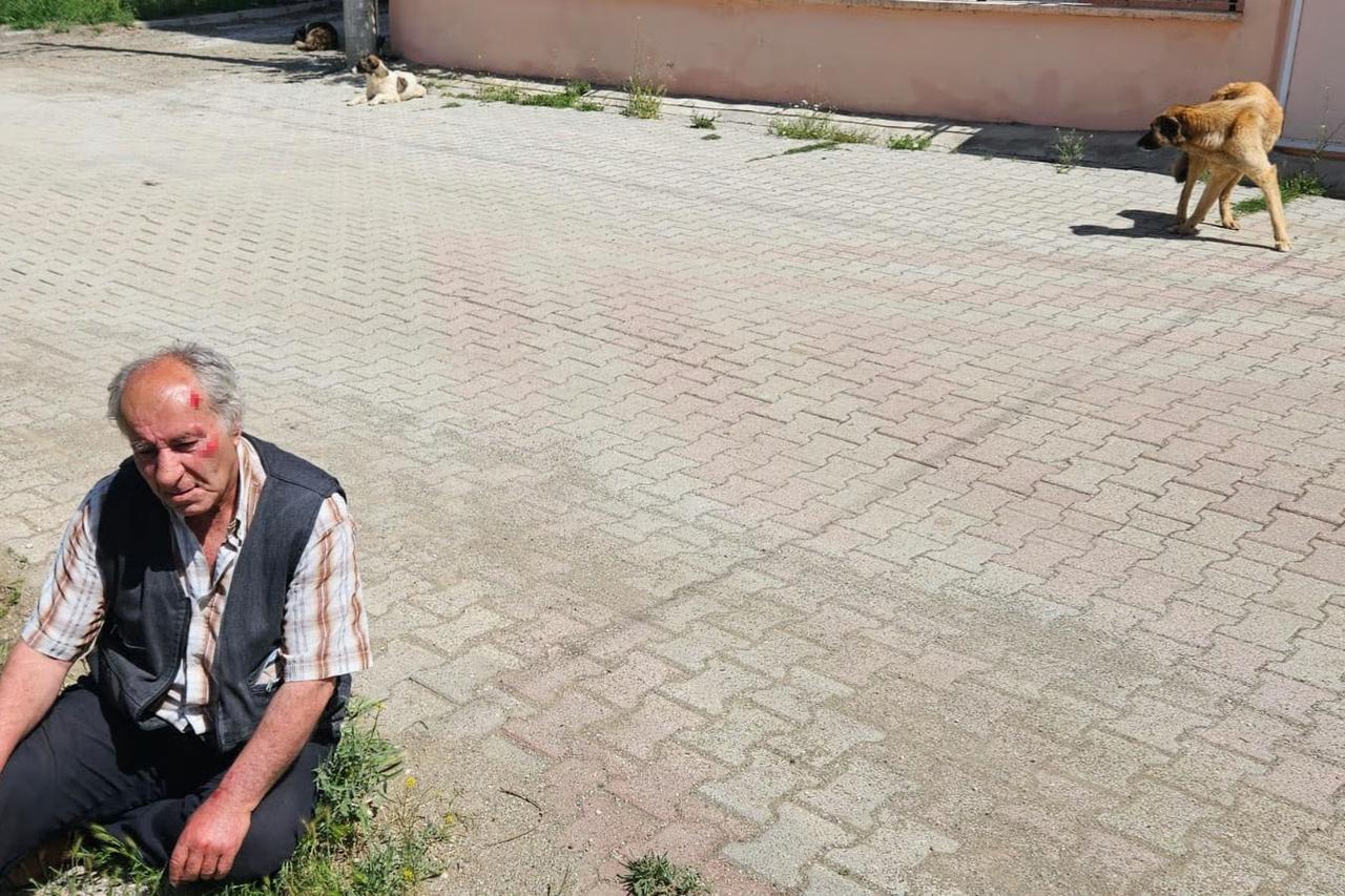 Başıboş köpeklerden kaçarken düşerek yaralandı