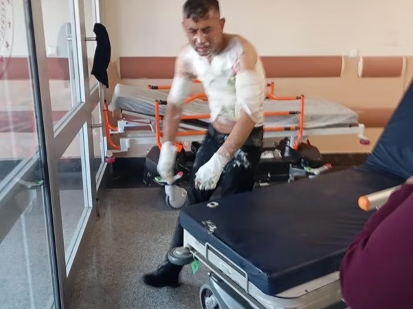 Engelli vatandaşın önce telefonunu çaldı sonra cani bir şekilde benzin döküp yaktı