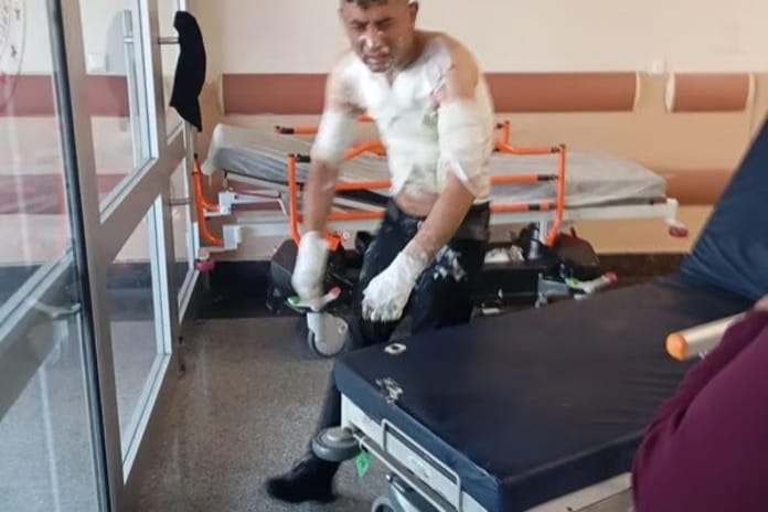 Engelli vatandaşın önce telefonunu çaldı sonra cani bir şekilde benzin döküp yaktı