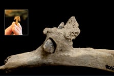 4000 yıllık kaburgaya saplanmış ok ucu bulundu