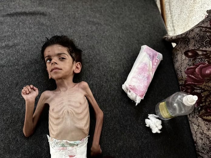 Gazze’de açlık can almaya devam ediyor: 24 saate 7 kişi açlıktan öldü