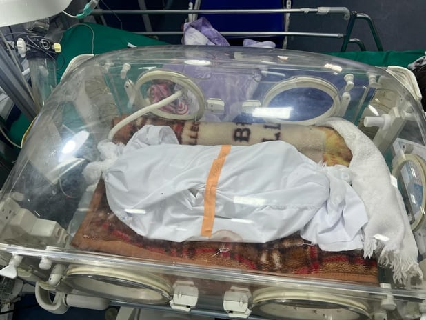 Gazze'de açlıktan ölen bebeklerin sayısı artıyor