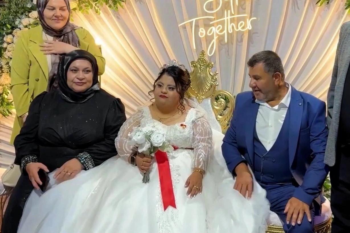 Down sendromlu Elif için temsili düğün yapıldı
