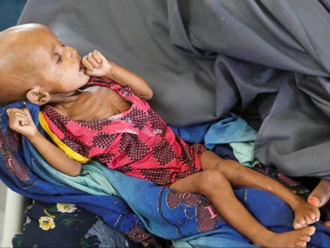 Cholera Outbreak Puts 80,000 Children At Risk In West Africa