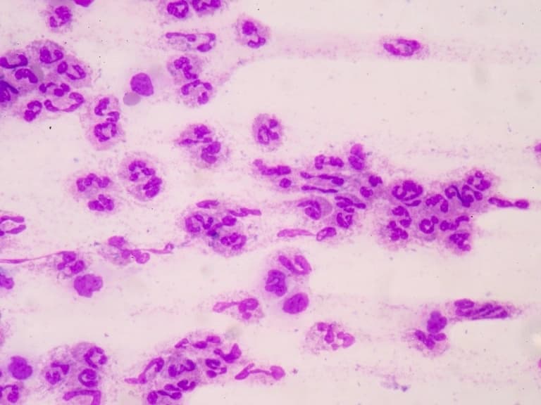 Sepsis hangi enfeksiyonlardan sonra gelişir