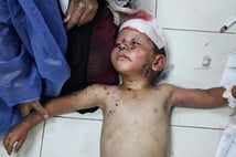 İsrail'in yaktığı çocuklar