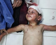 İsrail'in yaktığı çocuklar