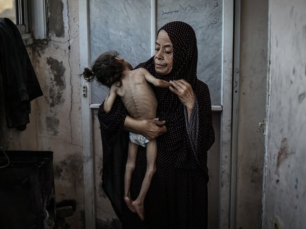 İsrailli kanal Gazze'de açlıktan ölen çocuğun annesiyle dalga geçti