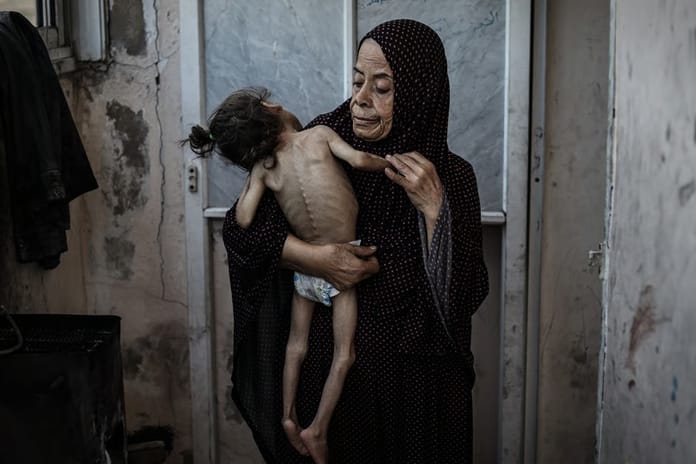 İsrailli kanal Gazze'de açlıktan ölen çocuğun annesiyle dalga geçti