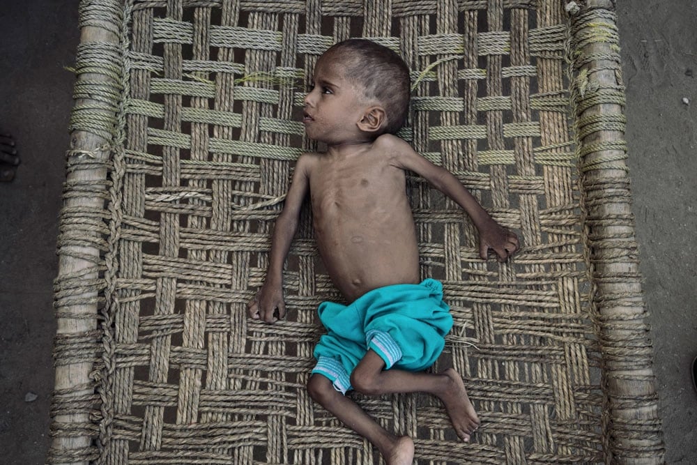 Yemen'de gıda güvensizliği alarmı