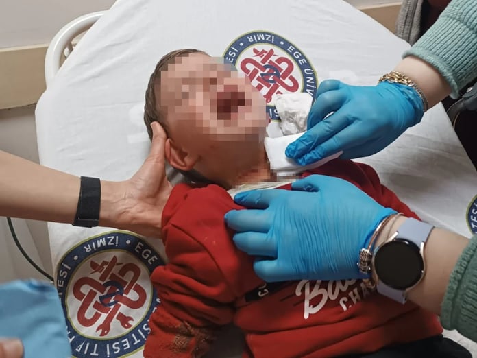 İzmir'de parkta oynayan üç yaşındaki çocuğa bıçaklı saldırı